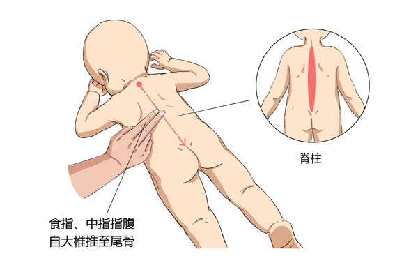 小儿推拿发烧退热手法——推脊柱